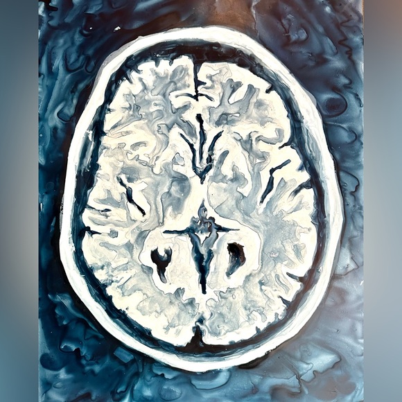 Brain Scan Original painting: acrylic fluid ink on yupo paper. Measures 20"x26" - Picture 2 of 3